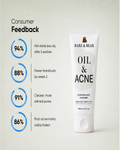 Consumer Study Results - 94% Less Oily 88% Fewer Breakouts